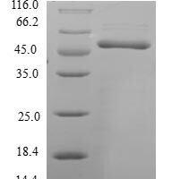 Human Cytochrome c-type heme lyase (HCCS) Recombinant Protein - BioCrest Sci