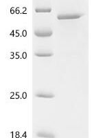 Human Leucine-rich repeat-containing G-protein coupled receptor 5 (LGR5), partial, Biotinylated Recombinant Protein - BioCrest Sci