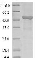 Human COMM domain-containing protein 1 (COMMD1) Recombinant Protein - BioCrest Sci