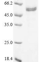 Human Scaffold protein ILK (ILK) Recombinant Protein, N-10His - BioCrest Sci