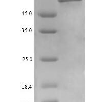 Human UDP-N-acetylhexosamine pyrophosphorylase (UAP1) Recombinant Protein, N-His, aa 1–522, Yeast - BioCrest Sci