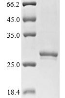 Dermatophagoides farinae Mite allergen Der f 6 (DERF6) Recombinant Protein - BioCrest Sci