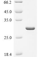 Saccharomyces cerevisiae NADPH-dependent methylglyoxal reductase GRE2 (GRE2), partial Recombinant Protein - BioCrest Sci