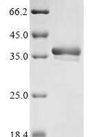 Dirofilaria immitis Pepsin inhibitor Dit33 (DIT33) Recombinant Protein - BioCrest Sci