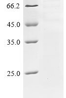 Human Maltase-glucoamylase, intestinal (MGAM), partial Recombinant Protein - BioCrest Sci