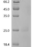 Macaca fascicularis Interferon beta (IFNB1) Recombinant Protein, C-10His - BioCrest Sci