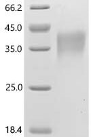 Human Triggering receptor expressed on myeloid cells 1 (TREM-1), partial Recombinant Protein - BioCrest Sci