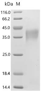 Human Triggering receptor expressed on myeloid cells 1 (TREM-1), partial Recombinant Protein, Homo sapiens (Human), Mammalian cell, C-terminal 10xHis-tagged, 21.6 kDa, purity >≥ 95% as determined by SDS-PAGE.