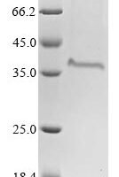 Bovine coronavirus Spike glycoprotein (S), partial Recombinant Protein, C-His, aa 314–634, strain 98TXSF-110-LUN - BioCrest Sci