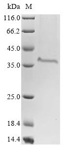 Bovine coronavirus Spike glycoprotein (S), partial Recombinant Protein, C-His, aa 314–634, strain 98TXSF-110-LUN, Bovine coronavirus (strain 98TXSF-110-LUN) (BCoV-LUN) (BCV), Mammalian cell, C-terminal 6xHis-tagged, 37.3 kDa, purity >≥ 85% as determined by SDS-PAGE.