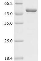 Mouse Matrix metalloproteinase-20 (Mmp20) Recombinant Protein - BioCrest Sci