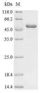 Mouse Matrix metalloproteinase-20 (Mmp20) Recombinant Protein, Mus musculus (Mouse), E.coli, C-terminal 6xHis-tagged, 49.7 kDa, purity >≥ 85% as determined by SDS-PAGE.