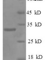 Human NK-tumor recognition protein (NKTR), partial Recombinant Protein - BioCrest Sci