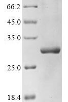Pseudomonas phage phi6 RNA-directed RNA polymerase (P2), partial Recombinant Protein - BioCrest Sci