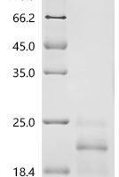 Mouse Interferon gamma (Ifng) Recombinant Protein, C-10His, aa 23–155, Yeast - BioCrest Sci