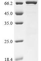 Human Creatine kinase M-type (CKM) Recombinant Protein - BioCrest Sci