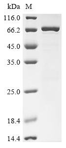 Human Creatine kinase M-type (CKM) Recombinant Protein, Homo sapiens (Human), E.coli, N-terminal GST-tagged, 70.6 kDa, purity >≥ 85% as determined by SDS-PAGE.