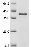 Human MRG/MORF4L-binding protein (MRGBP) Recombinant Protein - BioCrest Sci