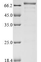 Human Acetylcholine receptor subunit alpha (CHRNA1), partial Recombinant Protein, N-His-PDI, aa 21–255, Yeast - BioCrest Sci
