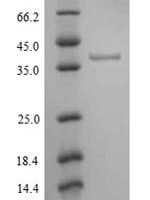 Human Tyrosine-protein kinase JAK1 (JAK1), partial Recombinant Protein - BioCrest Sci