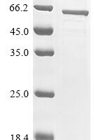 Anopheles gambiae Acetylcholinesterase (Ace), partial Recombinant Protein - BioCrest Sci