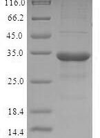 Cricetulus griseus C-C motif chemokine (LOC100763833) Recombinant Protein - BioCrest Sci