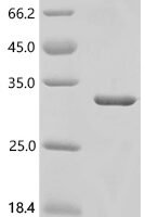 Human GTPase KRas (G12D), partial Recombinant Protein - BioCrest Sci
