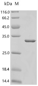 Human GTPase KRas (G12D), partial Recombinant Protein, Homo sapiens (Human), E.coli, N-terminal 10xHis-tagged, 24.6 kDa, purity >≥ 85% as determined by SDS-PAGE.
