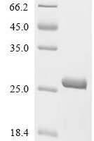 Human Tumor necrosis factor alpha-induced protein 2 (TNFAIP2), partial Recombinant Protein, C-His - BioCrest Sci