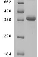 Human Coagulation factor IX (F9), partial Recombinant Protein, N-hFc1 - BioCrest Sci