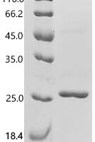 Mouse Leptin (Lep) Recombinant Protein - BioCrest Sci