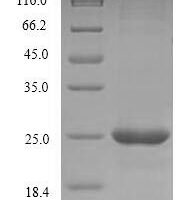 Human CD40 ligand (CD40LG), partial Recombinant Protein, N-His - BioCrest Sci