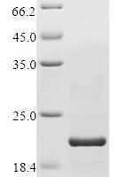 Human Disco-interacting protein 2 homolog C (DIP2C), partial Recombinant Protein, C-His - BioCrest Sci