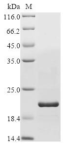 Human Disco-interacting protein 2 homolog C (DIP2C), partial Recombinant Protein, C-His, Homo sapiens (Human), Baculovirus, C-terminal 6xHis-tagged, 19 kDa, purity >≥ 85% as determined by SDS-PAGE.