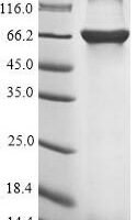 Rabies virus Glycoprotein (G), partial Recombinant Protein, N-10His-SUMO/C-Myc - BioCrest Sci