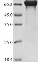 Human Grainyhead-like protein 2 homolog (GRHL2) Recombinant Protein - BioCrest Sci