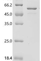 Mouse Neurogenic differentiation factor 1 (Neurod1) Recombinant Protein, C-His, aa 1–357, E.coli - BioCrest Sci