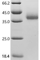 Macaca fascicularis Interleukin-2 receptor subunit beta (IL2RB), partial Recombinant Protein - BioCrest Sci