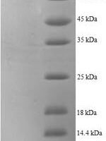 Human Prolyl endopeptidase FAP (FAP), partial Recombinant Protein, N-GST - BioCrest Sci
