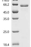 Human Heat shock protein HSP 90-alpha (HSP90AA1), partial Recombinant Protein, N-His-SUMOstar - BioCrest Sci