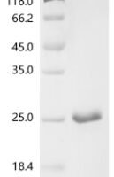 Human TATA-binding protein-associated factor 2N (TAF15), partial Recombinant Protein, C-His, aa 7–99 - BioCrest Sci