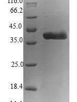 Human Astrocytic phosphoprotein PEA-15 (PEA15) Recombinant Protein - BioCrest Sci