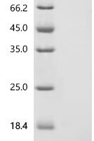 Bovine Regakine-1 Recombinant Protein, C-10His - BioCrest Sci