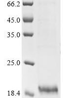 Pig Protegrin-2 (NPG2), partial Recombinant Protein - BioCrest Sci