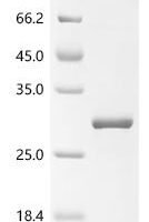 Mouse Complement component C8 gamma chain (C8g) Recombinant Protein - BioCrest Sci