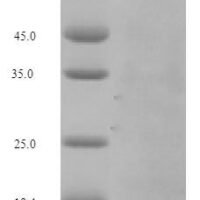 Mouse Complement factor B (Cfb) Recombinant Protein, N-His - BioCrest Sci
