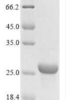 Bordetella pertussis Serotype 3 fimbrial subunit (fim3) Recombinant Protein, N-His - BioCrest Sci