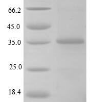 Rat Transforming growth factor beta-1 proprotein (Tgfb1), partial Recombinant Protein - BioCrest Sci