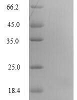 Human Perilipin-4 (PLIN4), partial Recombinant Protein, N-His, aa 308–418, Yeast - BioCrest Sci