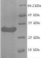 Human Leukocyte immunoglobulin-like receptor subfamily A member 5 (LILRA5), partial Recombinant Protein, N-His, aa 42–268, E.coli - BioCrest Sci